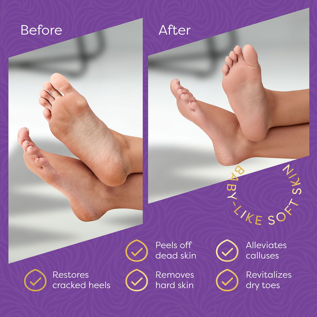 Aesta 3-in-1 Foot Peel Mask, Full-Cycle Foot Care: Revitalizing Mousse + Feet Peeling Mask + Moisturizing Cream | All-Natural Foot Peel Mask for Dry Cracked Feet | Baby Feet Foot Peel Treatment Set