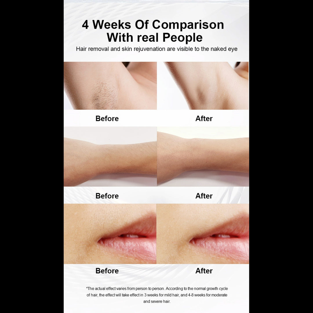 Numiere IPL Hair Removal with Ice Cooling by Numiere - Lumina NRG