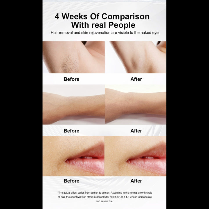 Numiere IPL Hair Removal with Ice Cooling by Numiere - Lumina NRG