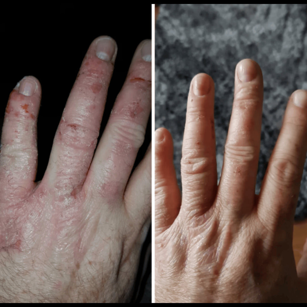 Numiere Hand Glow – LED Light Therapy for Hand & Wrist Rejuvenation by Numiere - Lumina NRG