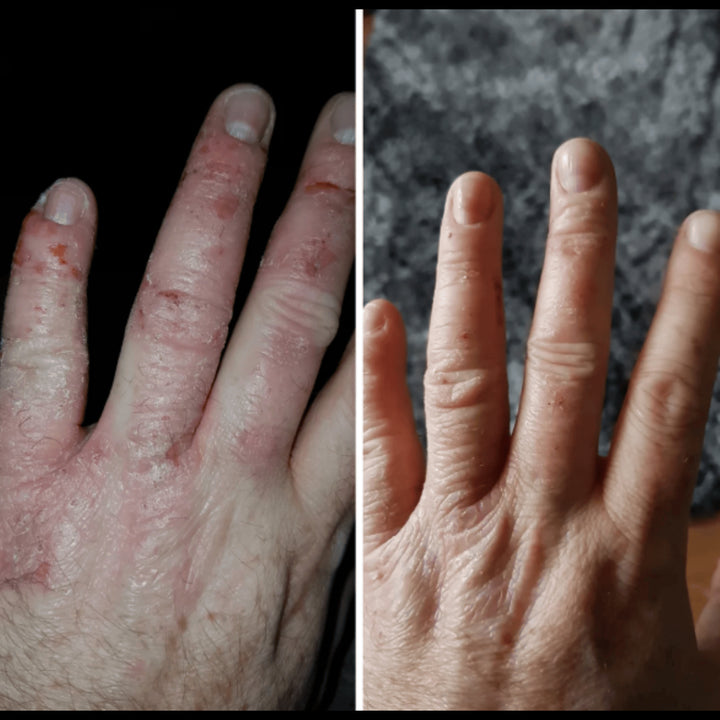 Numiere Hand Glow – LED Light Therapy for Hand & Wrist Rejuvenation by Numiere - Lumina NRG