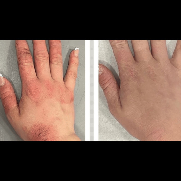 Numiere Hand Glow – LED Light Therapy for Hand & Wrist Rejuvenation by Numiere - Lumina NRG