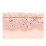 TIME OFF - Dissolvable Microneedle Hyaluronic Acid Patch Set (1 Month Supply)